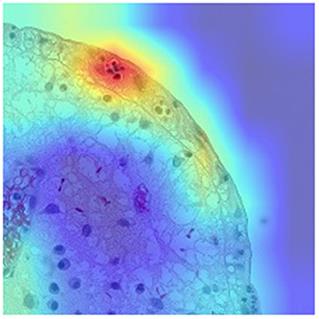 Technological advances in inflammatory bowel disease endoscopy and histology